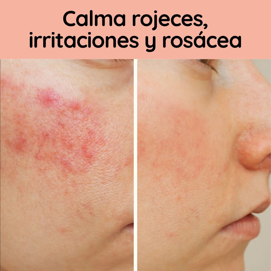 Sérum Restaurador e Hidratante