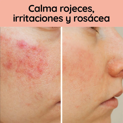 Sérum Restaurador e Hidratante